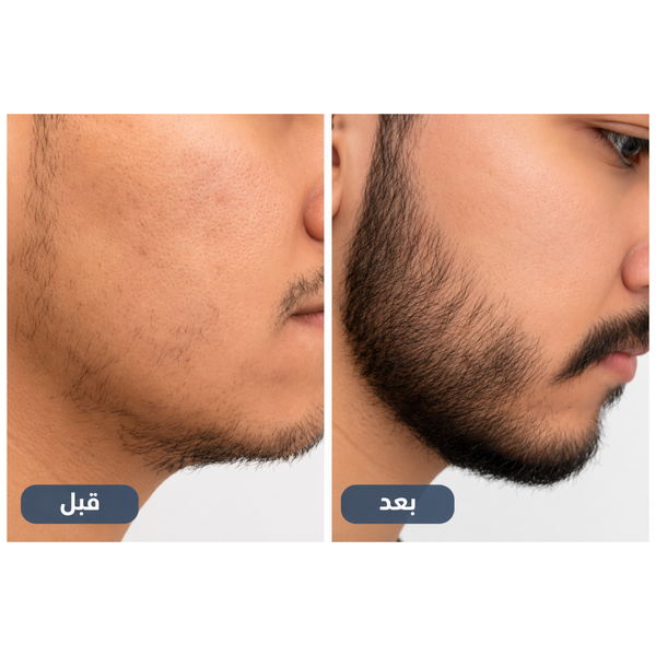 Member's Mark 5 % Minoxidil Liquide 4 Mois